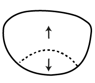 Standard Bifocal